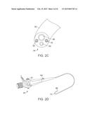 Torque Alleviating Intra-Airway Lung Volume Reduction Compressive Implant     Structures diagram and image