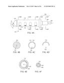 Torque Alleviating Intra-Airway Lung Volume Reduction Compressive Implant     Structures diagram and image