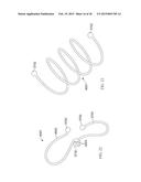 Torque Alleviating Intra-Airway Lung Volume Reduction Compressive Implant     Structures diagram and image