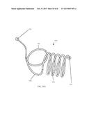 Torque Alleviating Intra-Airway Lung Volume Reduction Compressive Implant     Structures diagram and image