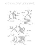 Torque Alleviating Intra-Airway Lung Volume Reduction Compressive Implant     Structures diagram and image