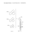 Torque Alleviating Intra-Airway Lung Volume Reduction Compressive Implant     Structures diagram and image