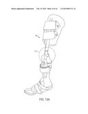 PROTECTIVE SLEEVE FOR A MEDICAL DEVICE diagram and image