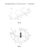 CONFORMABLE SUPPORT SYSTEM diagram and image