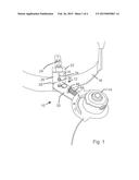 MOWER-MOUNTED TRIMMER diagram and image