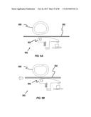 SYSTEMS AND METHODS FOR AUTOMATIC PRINT ALIGNMENT diagram and image