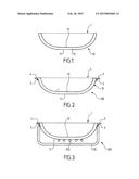 Method for Obtaining a Cooking Vessel Having a Colored Hard Anodized Outer     Face diagram and image