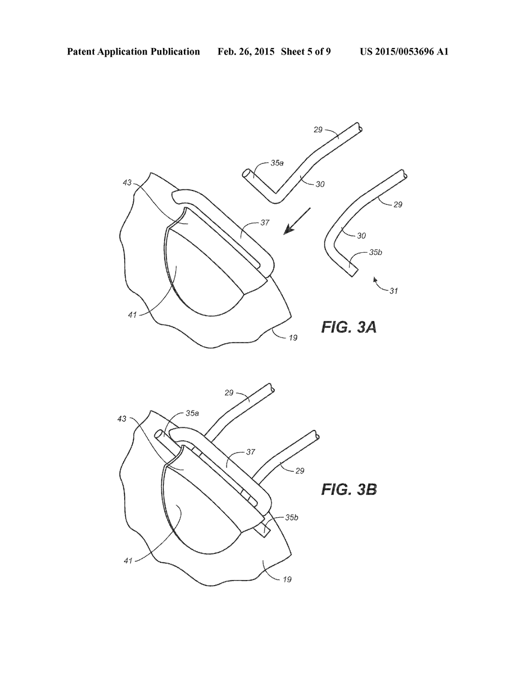 COOKING UTENSIL WITH A PINCH AND CATCH DETACHABLE HANDLE - diagram, schematic, and image 06