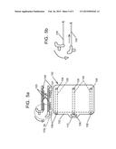 Apparatus and Method for Transporting a Patient in a Wheelchair diagram and image