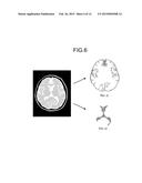 MAGNETIC RESONANCE IMAGING APPARATUS AND IMAGE PROCESSING APPARATUS diagram and image