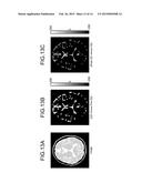 MAGNETIC RESONANCE IMAGING APPARATUS AND IMAGE PROCESSING APPARATUS diagram and image