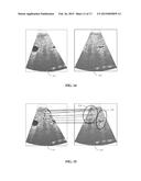 Intelligent Weighted Blending for Ultrasound Image Stitching diagram and image