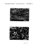 PROCESS FOR PROVIDING A TOPOGRAPHY TO THE SURFACE OF A DENTAL IMPLANT diagram and image