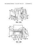 DENTAL DEVICE, AND METHOD FOR LINKING PHYSICAL AND DIGITAL DATA FOR     DIAGNOSTIC, TREATMENT PLANNING, PATIENT EDUCATION, COMMUNICATION,     MANUFACTURING, AND DATA TRANSFER PURPOSES diagram and image