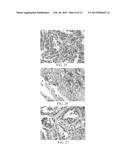 Systems and Methods for Anti-PAX8 Antibodies diagram and image