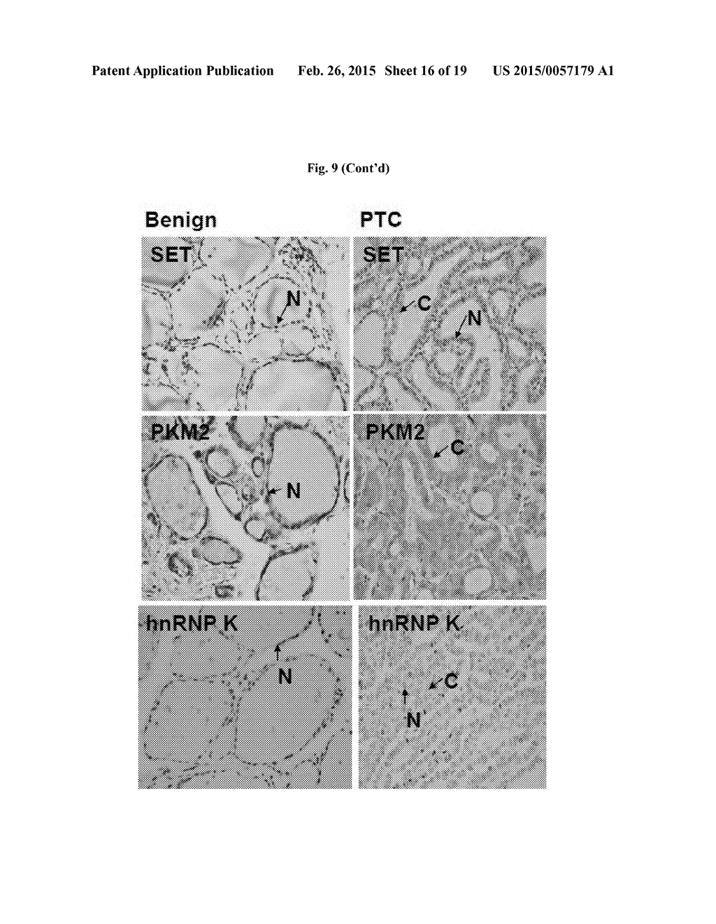 Methods and Compositions for hte Diagnosis and Treatment of Thyroid Cancer - diagram, schematic, and image 17