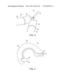 TISSUE RETRACTOR diagram and image