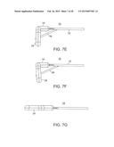 TISSUE RETRACTOR diagram and image