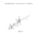 TISSUE RETRACTOR diagram and image