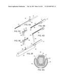 TISSUE RETRACTOR diagram and image