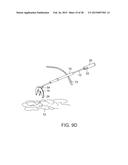 TISSUE RETRACTOR diagram and image