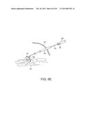 TISSUE RETRACTOR diagram and image