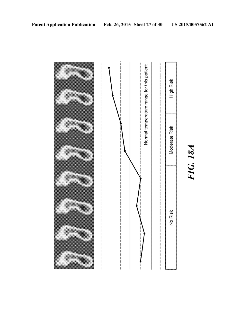 APPARATUS FOR MEASURING TEMPERATURE DISTRIBUTION ACROSS THE SOLE OF THE     FOOT - diagram, schematic, and image 28