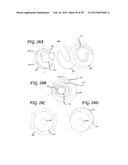 SOFT TISSUE CORING BIOPSY DEVICES AND METHODS diagram and image