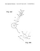 SOFT TISSUE CORING BIOPSY DEVICES AND METHODS diagram and image