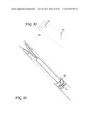 SOFT TISSUE CORING BIOPSY DEVICES AND METHODS diagram and image