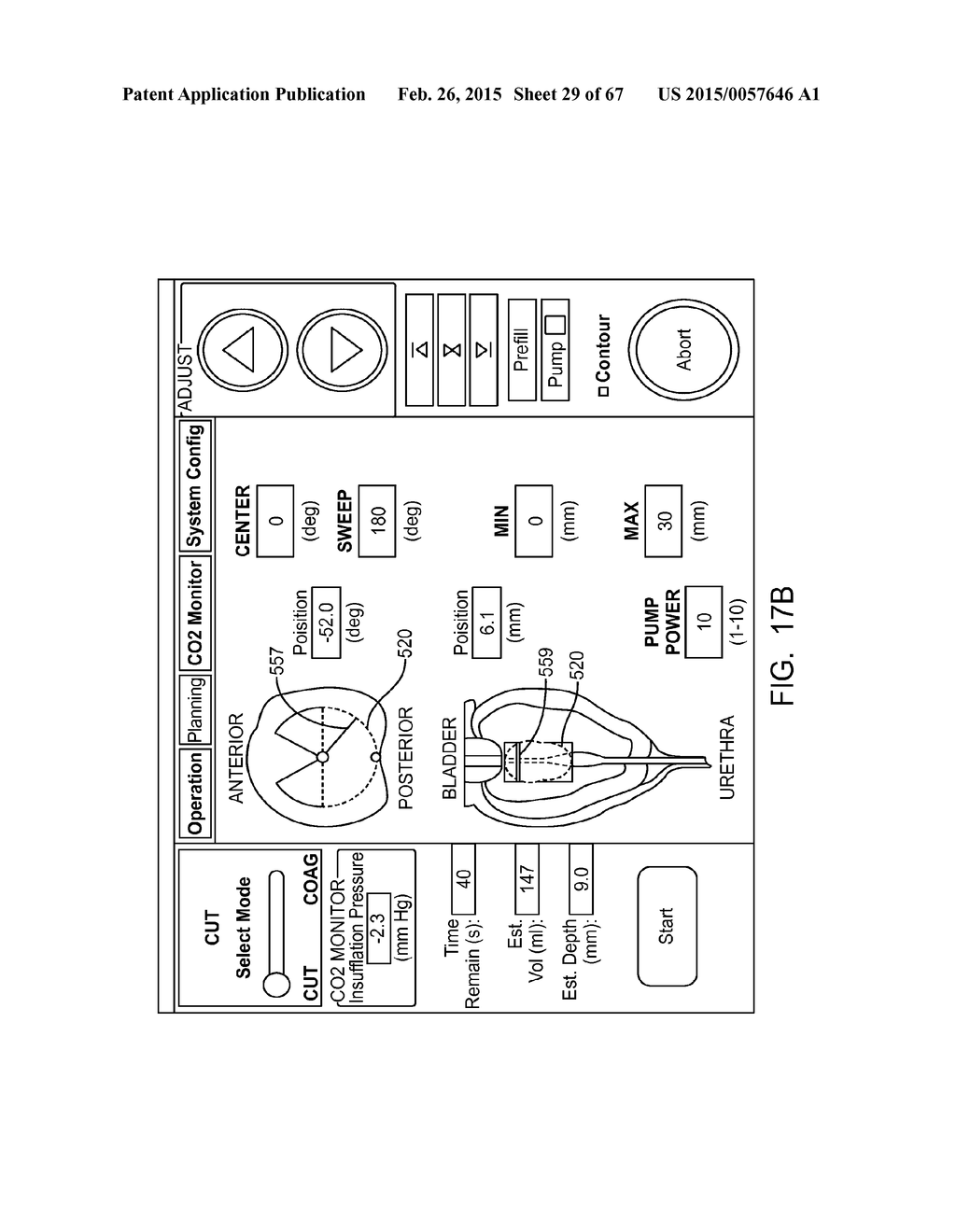 AUTOMATED IMAGE-GUIDED TISSUE RESECTION AND TREATMENT - diagram, schematic, and image 30