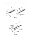 TISSUE TREATMENT APPARATUS AND METHODS diagram and image