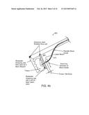 TISSUE TREATMENT APPARATUS AND METHODS diagram and image