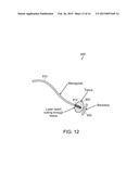 TISSUE TREATMENT APPARATUS AND METHODS diagram and image