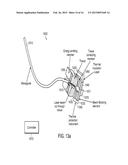 TISSUE TREATMENT APPARATUS AND METHODS diagram and image