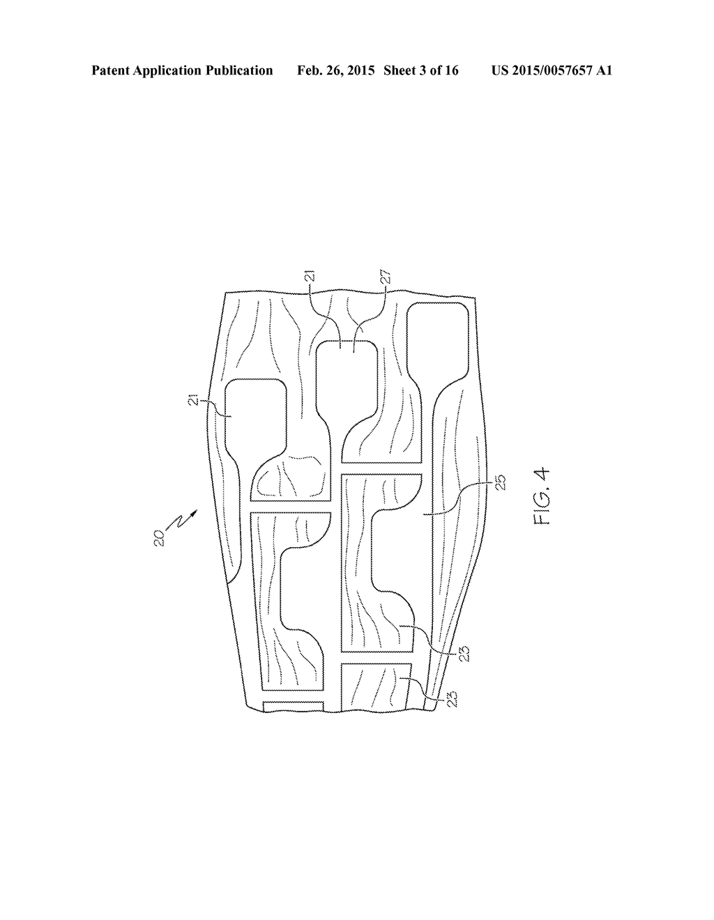 MEDICAL BALLOON HAVING PATTERNED RECESSED WALL PROFILE - diagram, schematic, and image 04