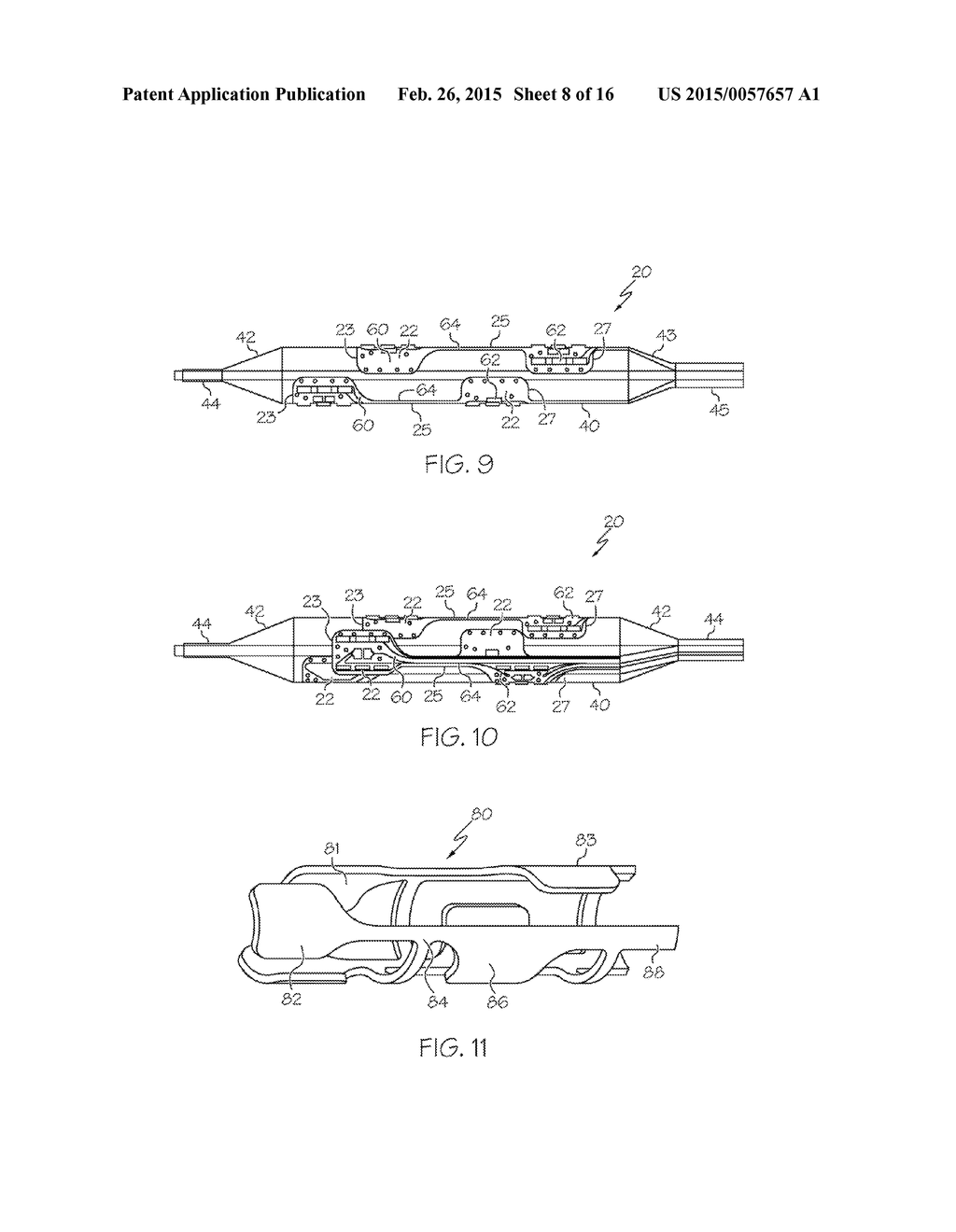 MEDICAL BALLOON HAVING PATTERNED RECESSED WALL PROFILE - diagram, schematic, and image 09