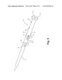 Intramedullary Nail, System, and Method With Dynamic Compression diagram and image