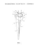 Osteotome Guide Configured to Attach to an Implanted Femoral Component diagram and image