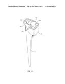 Osteotome Guide Configured to Attach to an Implanted Femoral Component diagram and image