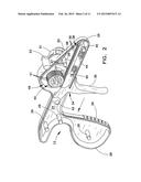 ENHANCED OUTER SHEATH FOR EXTRACTION DEVICE diagram and image