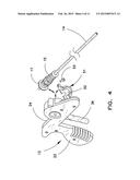 ENHANCED OUTER SHEATH FOR EXTRACTION DEVICE diagram and image