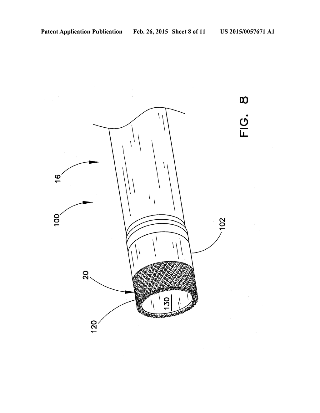 ENHANCED OUTER SHEATH FOR EXTRACTION DEVICE - diagram, schematic, and image 09