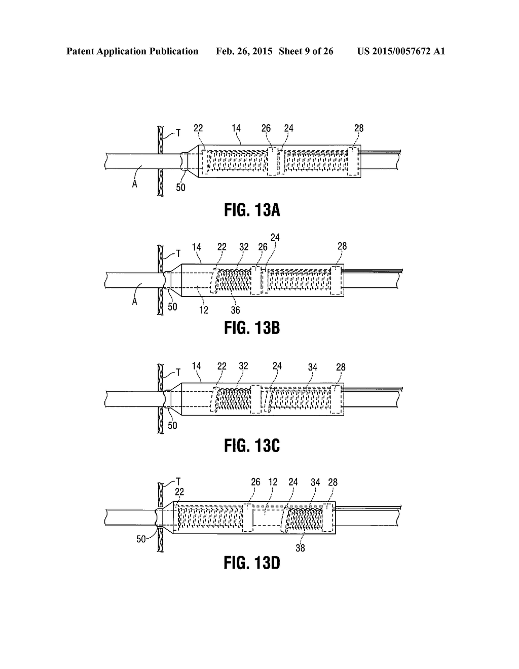 EXTRACTOR FOR REMOVING A LEAD FROM A PATIENT - diagram, schematic, and image 10