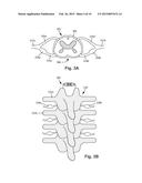 SYSTEMS AND METHODS FOR PROVIDING ELECTRICAL STIMULATION OF MULTIPLE     DORSAL ROOT GANGLIA WITH A SINGLE LEAD diagram and image