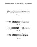 ELASTIC BAND LIGATION DEVICE WITH ANTI-PINCH FEATURE AND METHOD FOR     TREATMENT OF HEMORRHOIDS diagram and image