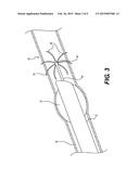 DEVICES AND METHODS FOR LUMEN OCCLUSION diagram and image