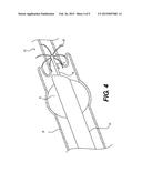 DEVICES AND METHODS FOR LUMEN OCCLUSION diagram and image