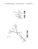 DEVICES AND METHODS FOR LUMEN OCCLUSION diagram and image