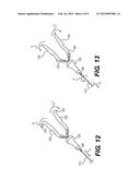 DEVICES AND METHODS FOR LUMEN OCCLUSION diagram and image